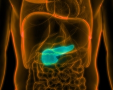 Pancreatic Cancer: Symptoms & Prevention
